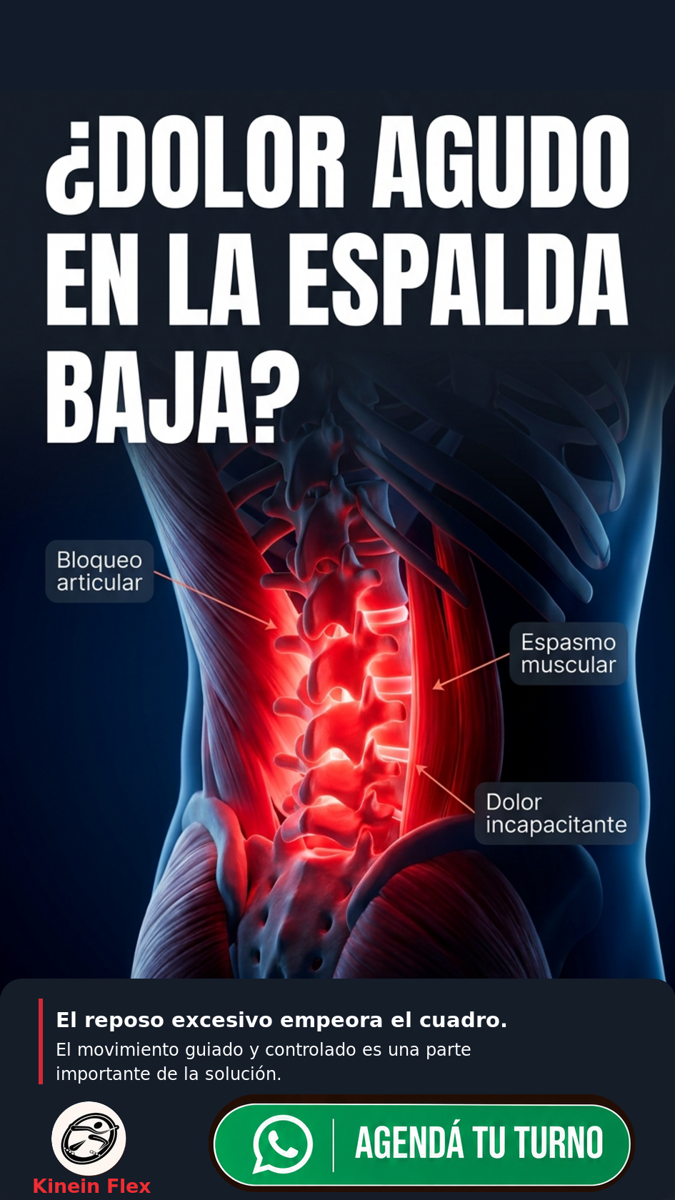 Publicación de Kinein Flex sobre dolor agudo en la espalda baja